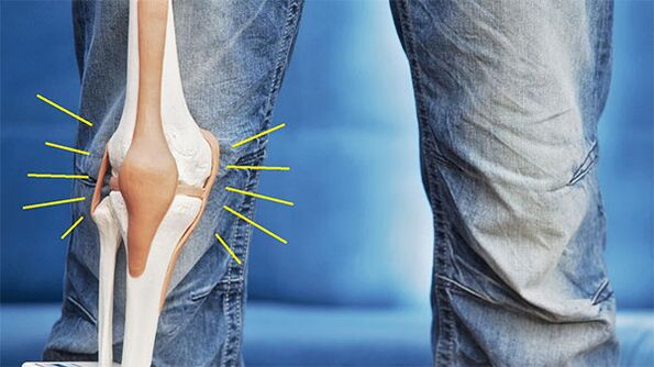 Schmerzen im Kniegelenk